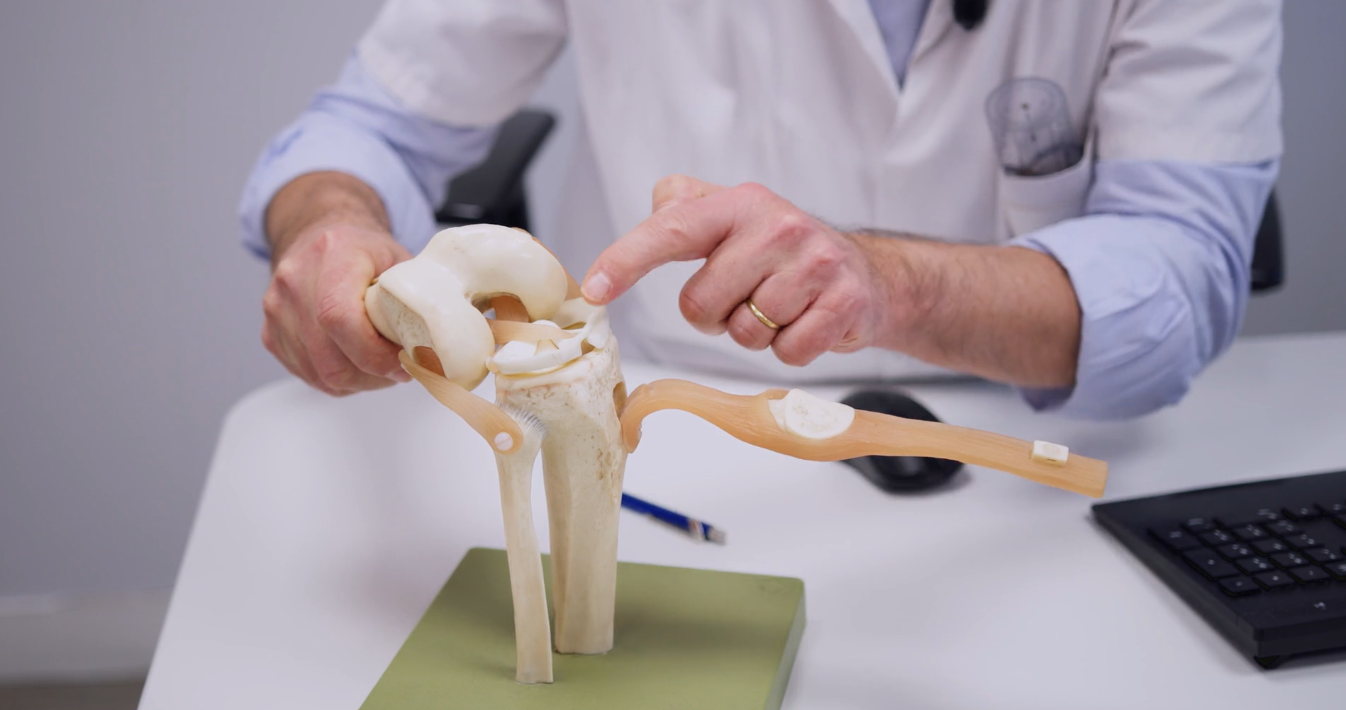 Entorse du genou avec rupture du LCA