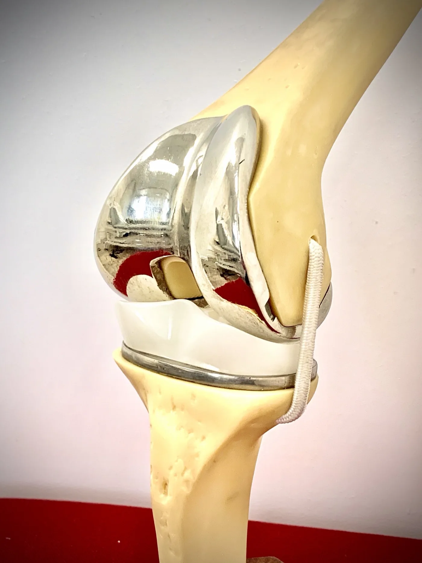 Maquette d'une prothèse totale de genou, vue de face